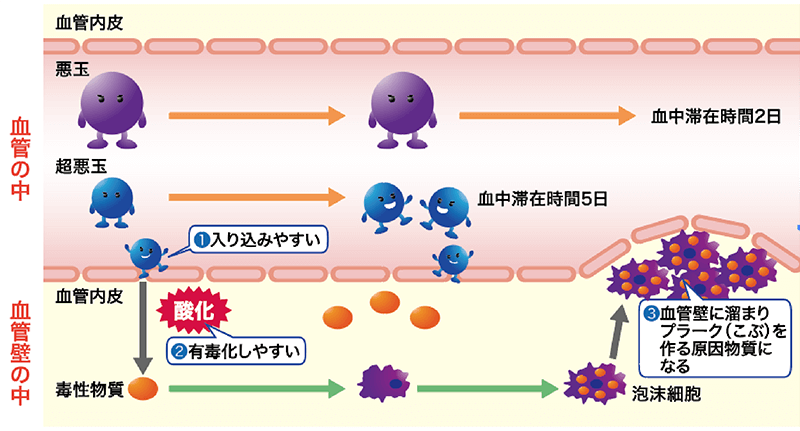 コース 料金 オプション検査 超悪玉コレステロール 健診センター カラダテラス海老名